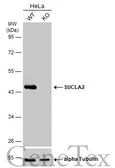 Anti-SUCLA2 antibody [N2C3] used in Western Blot (WB). GTX109728