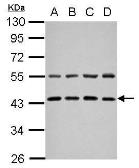 Anti-ZFYVE27 antibody [N3C3] used in Western Blot (WB). GTX109730