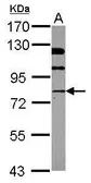 Anti-NSF antibody [N3C3] used in Western Blot (WB). GTX109731