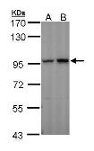 Anti-Aconitase 2 antibody [C1C3] used in Western Blot (WB). GTX109736