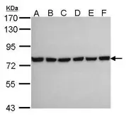 Anti-HSPA2 antibody [C1C3] used in Western Blot (WB). GTX109739