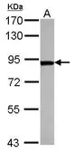 Anti-ThrRS antibody used in Western Blot (WB). GTX109743