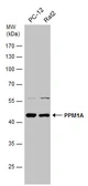 Anti-PPM1A antibody used in Western Blot (WB). GTX109744