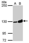 Anti-Vinculin antibody [N3C1], Internal used in Western Blot (WB). GTX109749