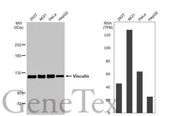 Anti-Vinculin antibody [N3C1], Internal used in Western Blot (WB). GTX109749