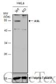 Anti-ASL antibody used in Western Blot (WB). GTX109750