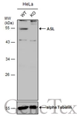 Anti-ASL antibody used in Western Blot (WB). GTX109750