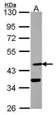 Anti-Dhh antibody [N3C3] used in Western Blot (WB). GTX109762