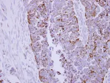 Anti-DLAT antibody used in IHC (Paraffin sections) (IHC-P). GTX109766