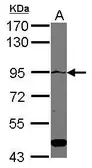 Anti-ATP2C1 antibody [C1C2], Internal used in Western Blot (WB). GTX109770