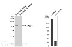 Anti-ATP2C1 antibody [C1C2], Internal used in Western Blot (WB). GTX109770