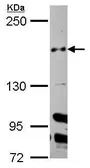 Anti-Cullin 7 antibody [N2N3] used in Western Blot (WB). GTX109785