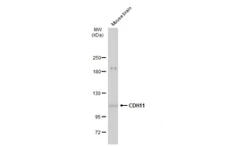 Anti-CDH11 antibody used in Western Blot (WB). GTX109792