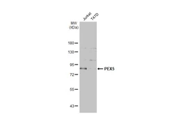 Anti-PEX5 antibody used in Western Blot (WB). GTX109798