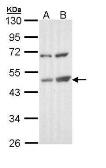 Anti-TSPYL1 antibody used in Western Blot (WB). GTX109809