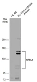 Anti-NPR-A antibody used in Western Blot (WB). GTX109810