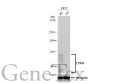 Anti-LYAG antibody [C2C3], C-term used in Western Blot (WB). GTX109821