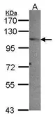 Anti-PEX6 antibody used in Western Blot (WB). GTX109826