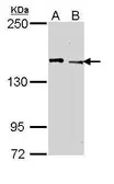 Anti-JARID1C antibody [N1N2], N-term used in Western Blot (WB). GTX109831