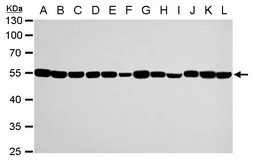 Anti-alpha Tubulin 1A antibody used in Western Blot (WB). GTX109832