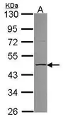 Anti-CCM2 antibody [N1C2] used in Western Blot (WB). GTX109835