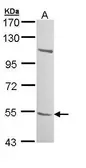Anti-B3GALTL antibody used in Western Blot (WB). GTX109849