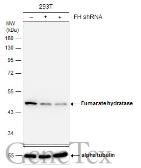 Anti-Fumarate hydratase antibody used in Western Blot (WB). GTX109877