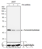 Anti-Fumarate hydratase antibody used in Western Blot (WB). GTX109877