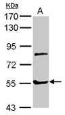 Anti-Myotilin antibody used in Western Blot (WB). GTX109905