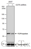 Anti-TCP1 epsilon antibody [N1N3] used in Western Blot (WB). GTX109908