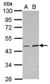 Anti-BAAT antibody used in Western Blot (WB). GTX109917