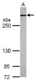 Anti-Filamin A antibody [N2], N-term used in Western Blot (WB). GTX109931