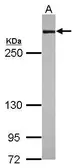 Anti-Filamin A antibody [N2], N-term used in Western Blot (WB). GTX109931