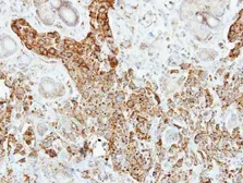 Anti-Pancreatic Lipase antibody [N1C1] used in IHC (Paraffin sections) (IHC-P). GTX109936