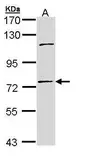 Anti-POLH antibody [N1N3] used in Western Blot (WB). GTX109938