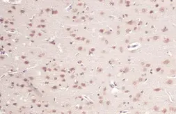 Anti-O-GlcNAc transferase antibody used in IHC (Paraffin sections) (IHC-P). GTX109939