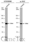 Anti-Villin antibody used in Western Blot (WB). GTX109940