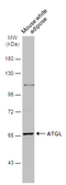 Anti-ATGL antibody [N1C1] used in Western Blot (WB). GTX109941