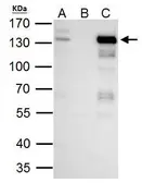 Anti-TTF2 antibody used in Immunoprecipitation (IP). GTX109947