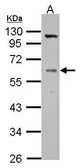 Anti-Vitamin D Binding Protein antibody used in Western Blot (WB). GTX109955
