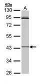 Anti-CRLF1 antibody [N2C3] used in Western Blot (WB). GTX109958