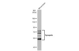 Anti-Synapsin antibody used in Western Blot (WB). GTX109960