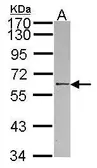 Anti-RBMY1A1 antibody [N1N3] used in Western Blot (WB). GTX109967