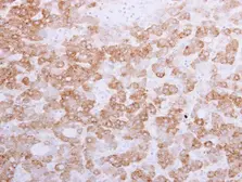 Anti-58K Golgi protein antibody [N1N3] used in IHC (Paraffin sections) (IHC-P). GTX109972
