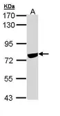 Anti-NCOA62 antibody [N3C3] used in Western Blot (WB). GTX109978