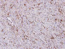 Anti-Trehalase antibody [N1N3] used in IHC (Paraffin sections) (IHC-P). GTX109979