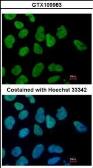 Anti-SALL4 antibody [C1C2], Internal used in Immunocytochemistry/ Immunofluorescence (ICC/IF). GTX109983