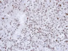 Anti-SALL4 antibody [C1C2], Internal used in IHC (Paraffin sections) (IHC-P). GTX109983