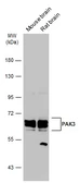 Anti-PAK3 antibody used in Western Blot (WB). GTX109991