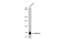 Anti-XPNPEP2 antibody [N3C3] used in Western Blot (WB). GTX109995